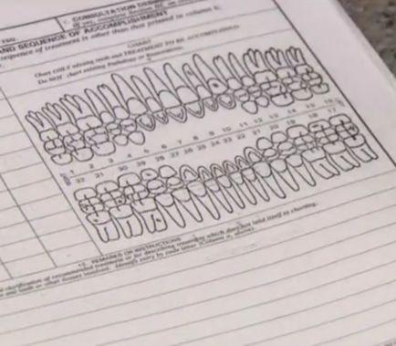 Dental Chart