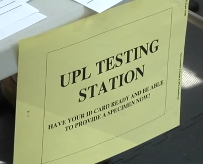 Urinalysis Sign